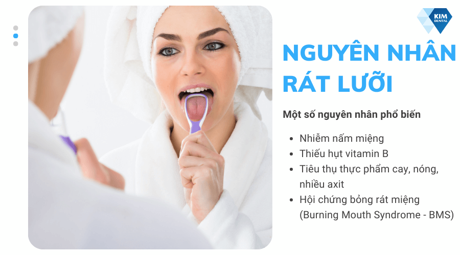 Nguyên nhân rát lưỡi