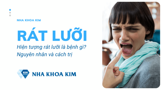 Rát lưỡi là bệnh gì? Nguyên nhân và cách chữa rát lưỡi