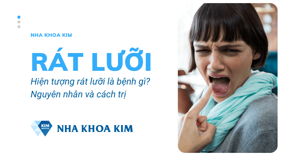 Rát lưỡi là bệnh gì? Nguyên nhân và cách chữa rát lưỡi