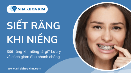 Siết răng khi niềng là gì? Lưu ý và cách giảm đau nhanh chóng