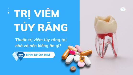 Thuốc trị viêm tủy răng tại nhà và nên kiêng ăn gì?