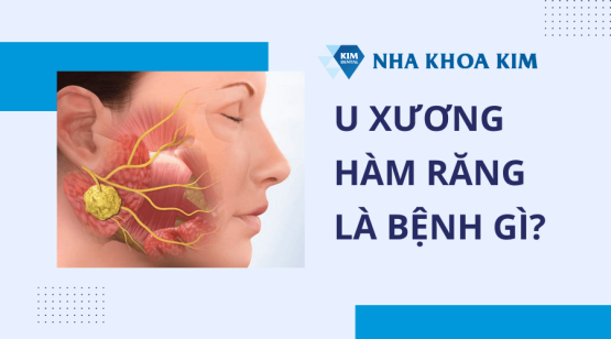 U xương hàm răng: Nguyên nhân, dấu hiệu và cách điều trị