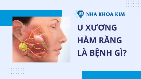 U xương hàm răng: Nguyên nhân, dấu hiệu và cách điều trị