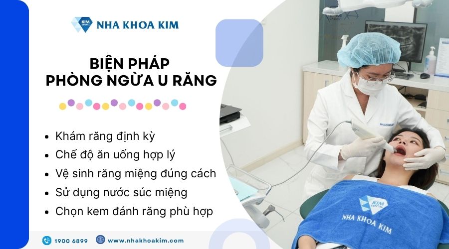 Biện pháp phòng ngừa u răng