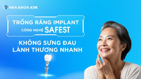 Công nghệ trồng răng Implant SAFEST nhanh tại Nha Khoa Kim