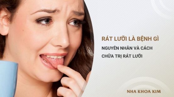 Rát lưỡi là bệnh gì? Nguyên nhân và cách chữa rát lưỡi