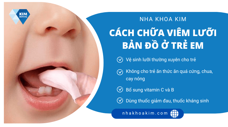 Cách chữa viêm lưỡi bản đồ ở trẻ em