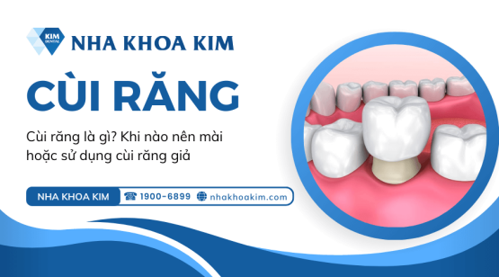 Cùi răng là gì? Khi nào nên mài hoặc sử dụng cùi răng giả