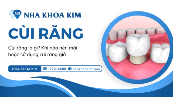 Cùi răng là gì? Khi nào nên mài hoặc sử dụng cùi răng giả