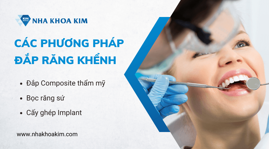 Các phương pháp đắp răng khểnh và thời gian sử dụng 