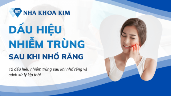 12 Dấu hiệu nhiễm trùng sau khi nhổ răng và cách xử lý kịp thời