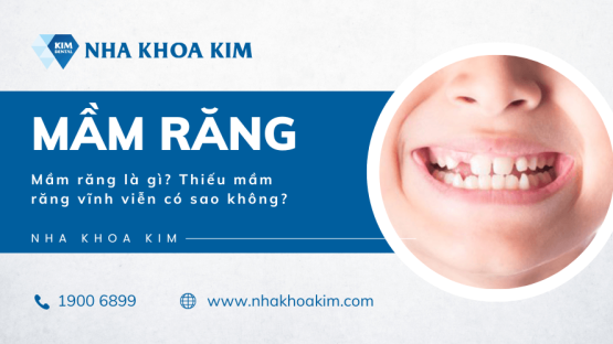 Mầm răng là gì? Thiếu mầm răng vĩnh viễn có sao không?