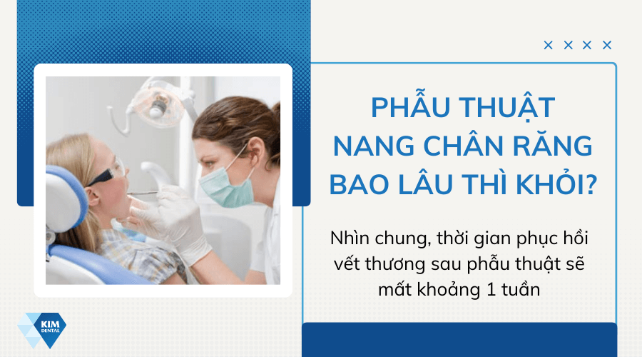 Phẫu thuật nang chân răng bao lâu thì khỏi