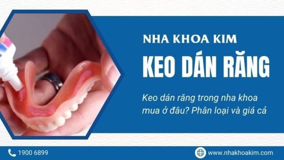 Keo dán răng sứ trong nha khoa mua ở đâu? Giá cả và cách phân loại