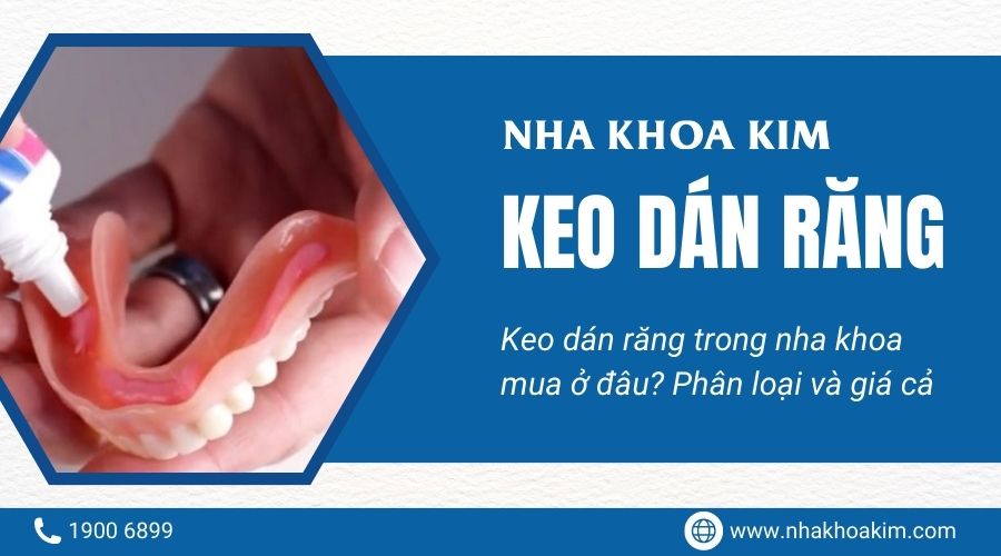 Keo dán răng sứ trong nha khoa mua ở đâu? Giá cả và cách phân loại