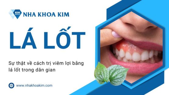 Sự thật về cách trị viêm lợi bằng lá lốt trong dân gian