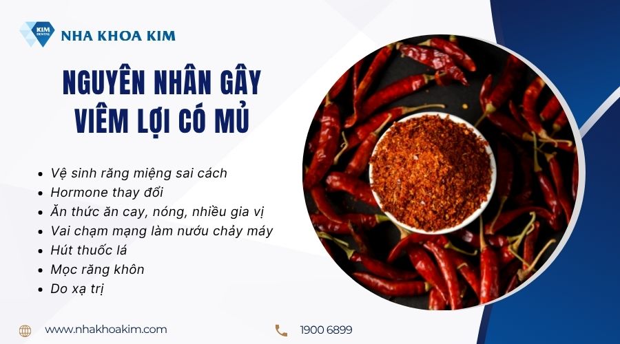 Nguyên nhân gây viêm lợi có mủ