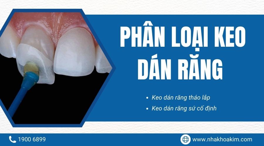 phân loại keo dán răng