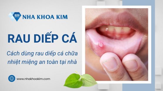 Cách dùng rau diếp cá chữa nhiệt miệng an toàn tại nhà