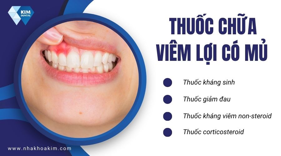 thuốc chữa viêm lợi có mủ