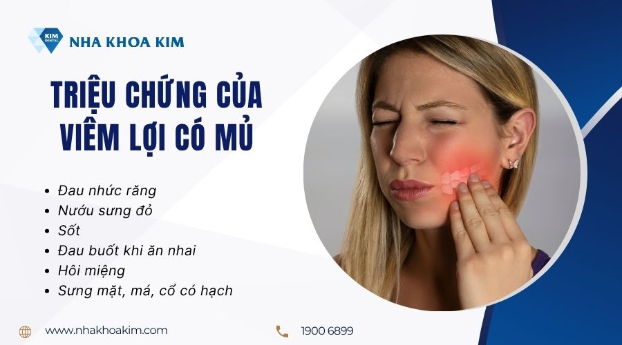 Các triệu chứng của viêm lợi có mủ