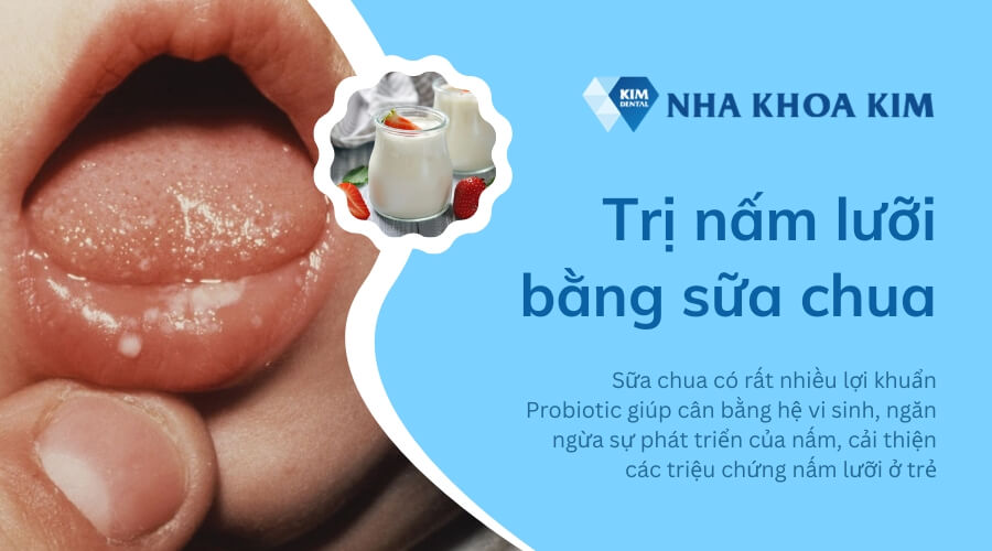 5 Mẹo dân gian giúp điều trị nấm lưỡi cho trẻ 