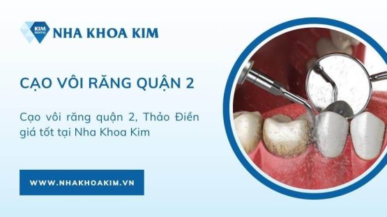 Cạo vôi răng Quận 2, Thảo Điền giá tốt tại Nha Khoa Kim