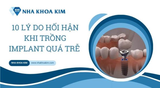 Những hối hận khi trồng implant nên cân nhắc