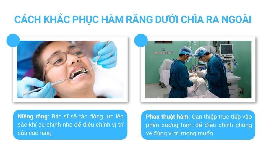 Cách khắc phục hàm dưới chìa ra ngoài 