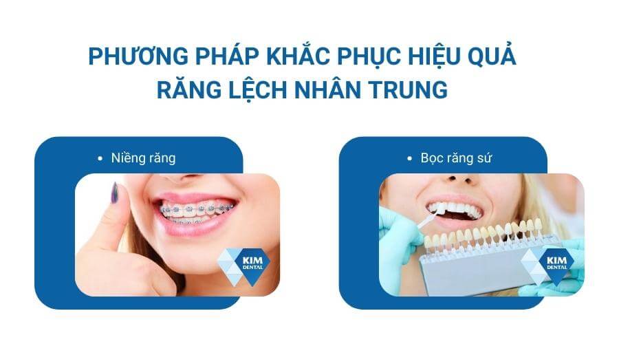 Phương pháp chỉnh răng lệch nhân trung