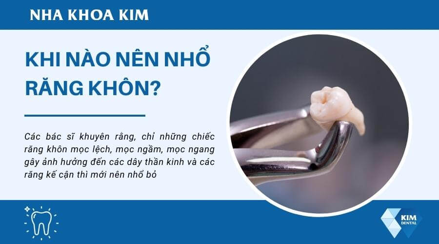 Khi nào nên nhổ răng khôn? 