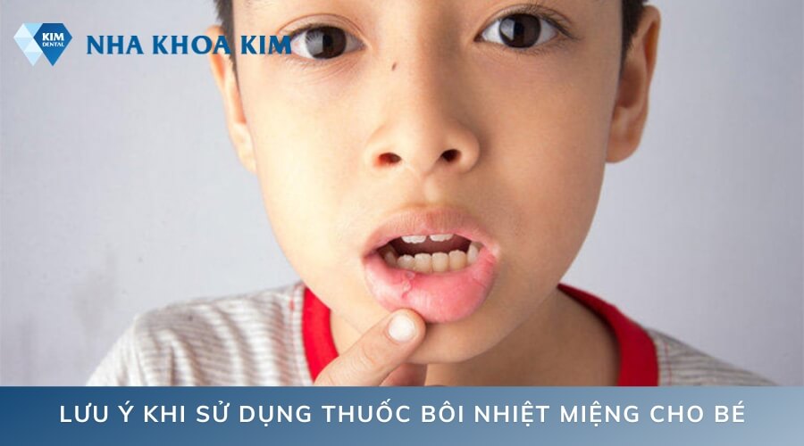 Lưu ý điều gì khi sử dụng thuốc bôi nhiệt miệng cho bé?