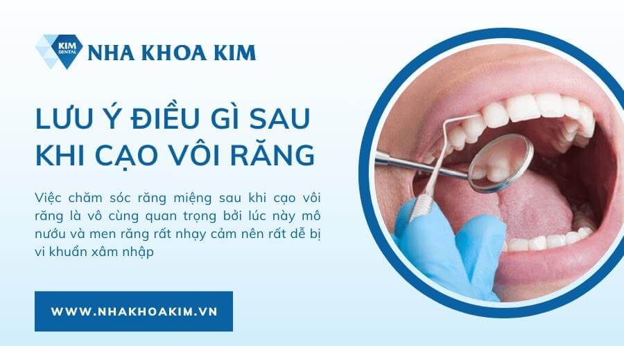 Những lưu ý cần biết sau khi cạo vôi răng