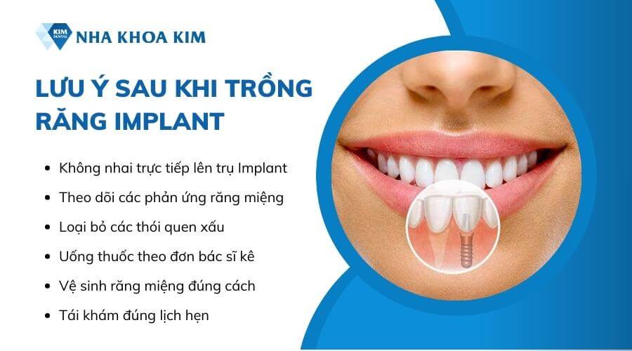 06 Lưu ý sau khi trồng răng Implant