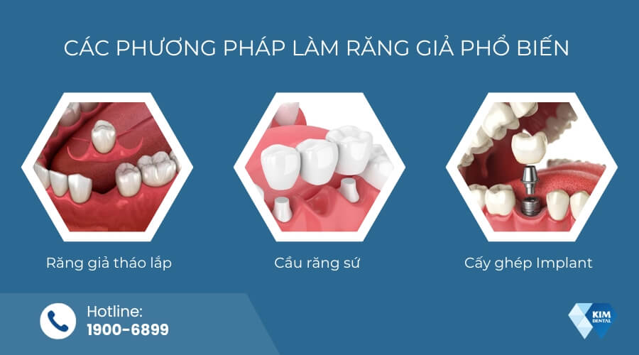 Mất răng lâu năm có trồng được không?