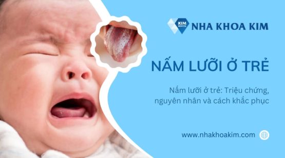 Nấm lưỡi ở trẻ: Triệu chứng, nguyên nhân và cách khắc phục