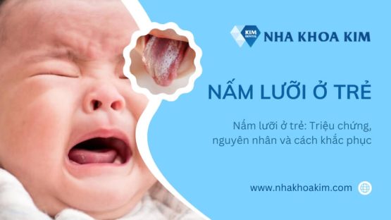 Nấm lưỡi ở trẻ: Triệu chứng, nguyên nhân và cách khắc phục