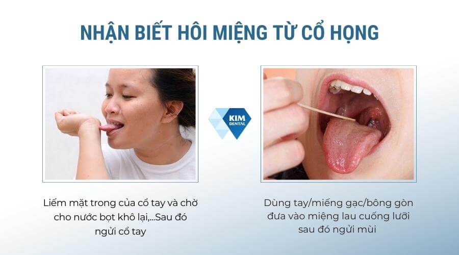 Họng có mùi hôi: Nguyên nhân và giải pháp điều trị hiệu quả