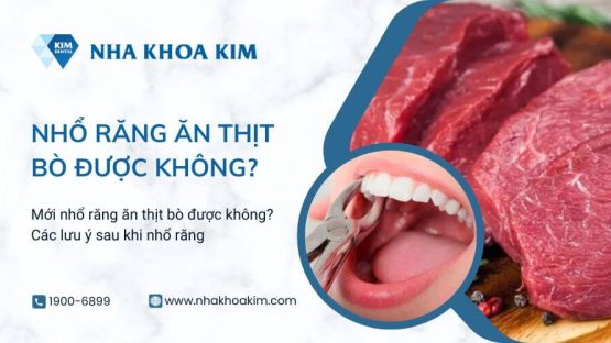 Mới nhổ răng ăn thịt bò được không? Các lưu ý sau khi nhổ răng