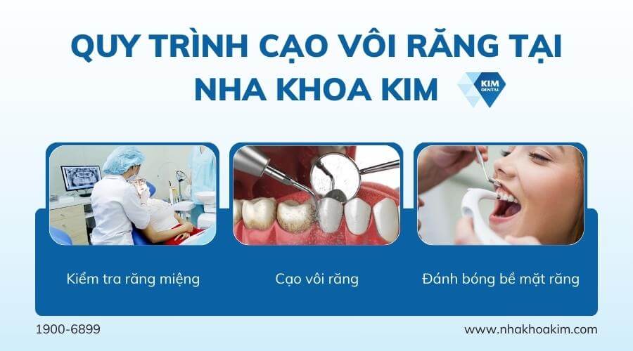 Quy trình cạo vôi răng tại Nha Khoa Kim