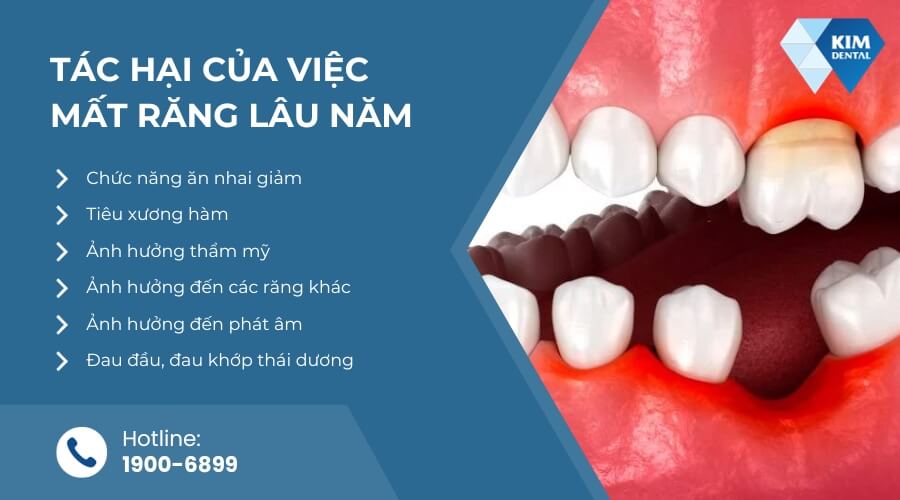 Tác hại của việc mất răng lâu năm