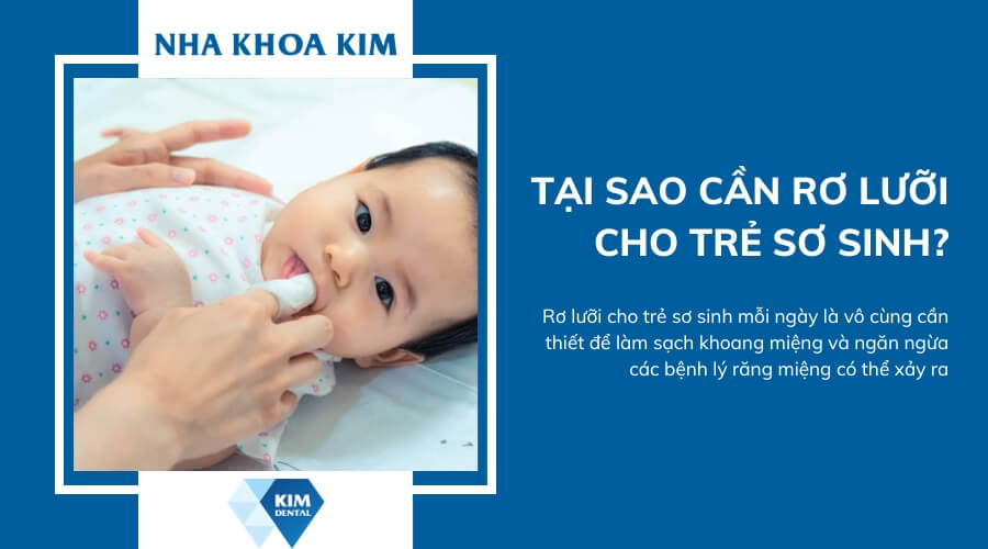 Có nên rơ lưỡi cho trẻ sơ sinh?