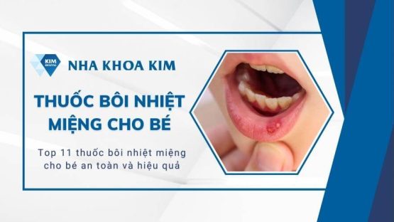 Top 11 thuốc bôi nhiệt miệng cho bé an toàn và hiệu quả