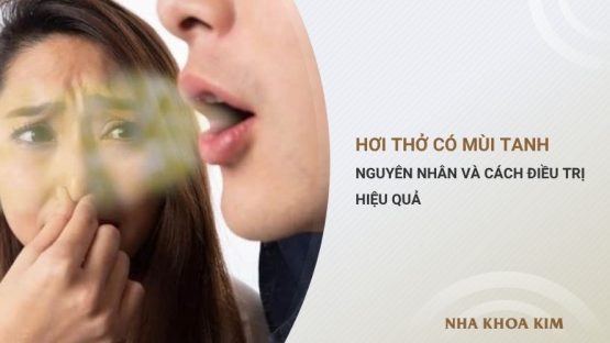 Hơi thở có mùi tanh là bệnh gì? Nguyên nhân và cách điều trị