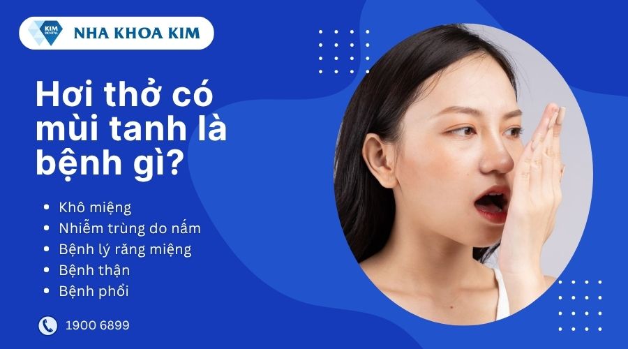 hơi thở có mùi tanh là bệnh gì