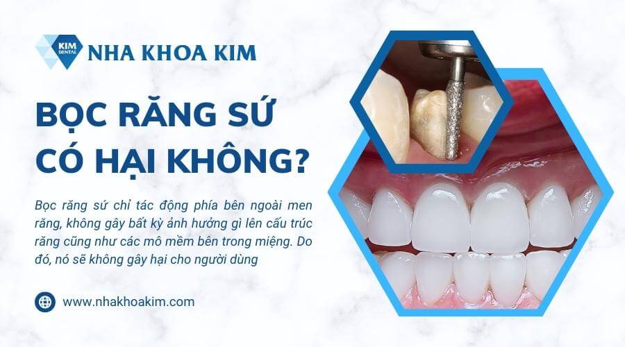 Bọc răng sứ có hại không?