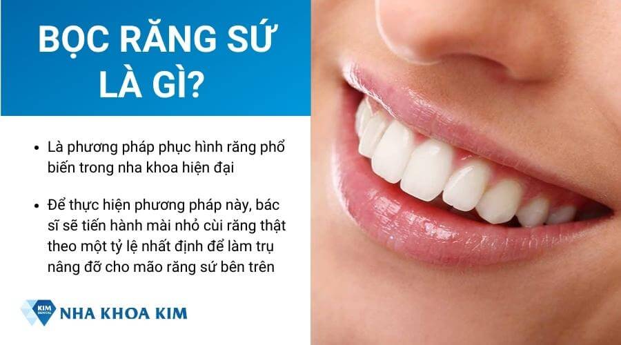 Bọc răng sứ là gì?