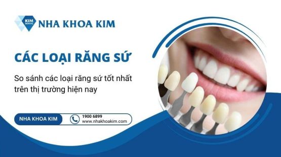 So sánh ưu và nhược điểm của các loại răng sứ hiện nay