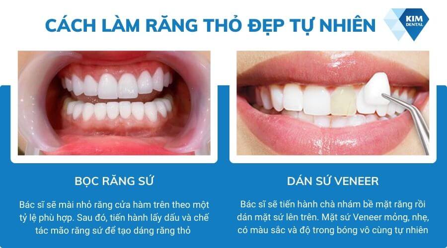 Cách làm răng sứ thỏ tự nhiên, phù hợp với khuôn mặt