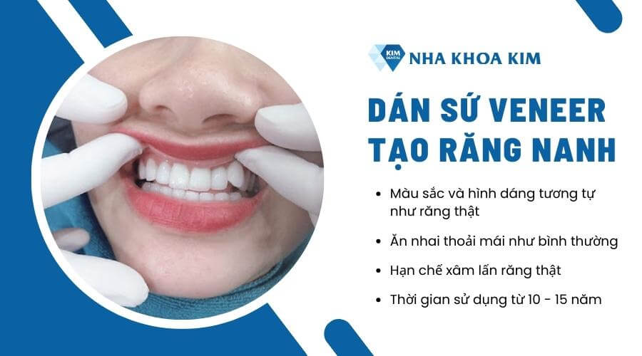 Cách sở hữu răng nanh đẹp, tự nhiên